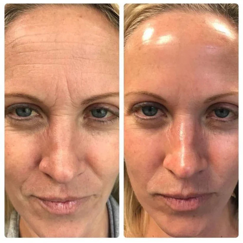 Sérum facial reafirmante con retinol coreano