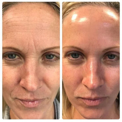Sérum facial reafirmante con retinol coreano