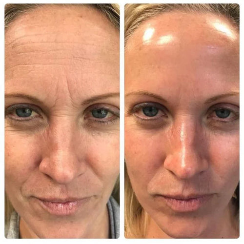 Sérum facial reafirmante con retinol coreano
