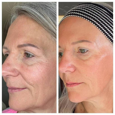 Cepillo Facial para drenaje linfatico