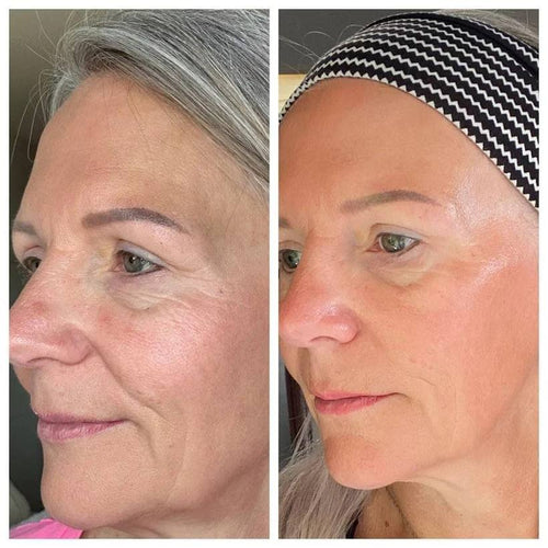 Cepillo Facial para drenaje linfatico